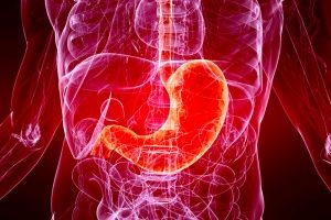 Treat Chronic Gastritis with Chinese Herbal Medicine